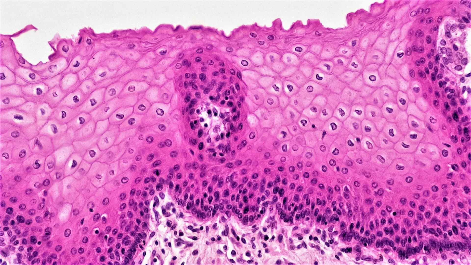 Pathology foundation models