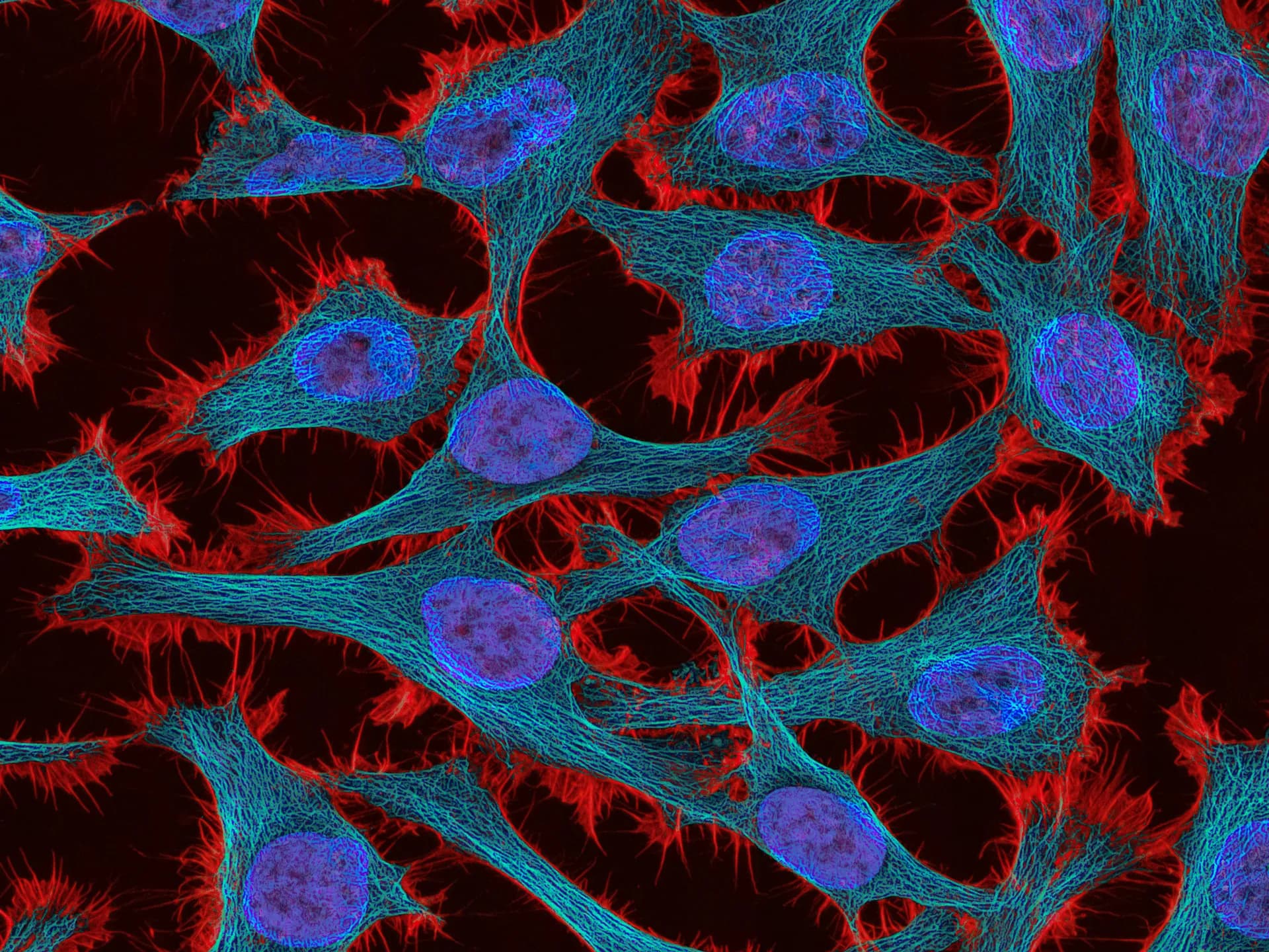 Protein foundation models